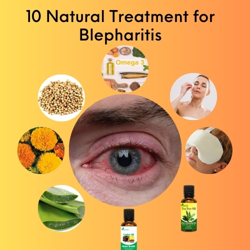 10 Natural Treatment For Blepharitis Herbal Care Products Blog 10 Natural Treatment For Blepharitis Herbal Care Products Blog