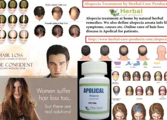 10 Natural Treatments for Alopecia Areata
