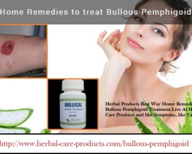 11 Herbal Treatment for Bullous Pemphigoid