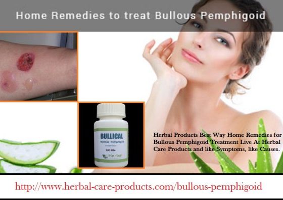 11 Herbal Treatment for Bullous Pemphigoid