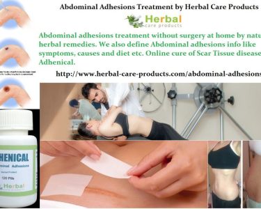 11-Natural-Home-Remedies-for-Abdominal-Adhesions