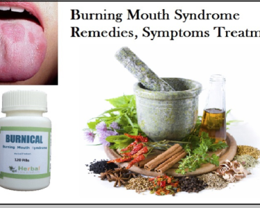 Burning Mouth Syndrome Remedies, Symptoms Treatment