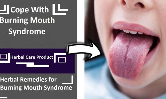 How to Cope With Burning Mouth Syndrome At Home