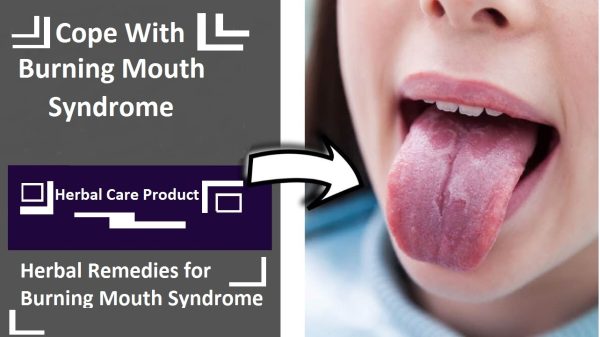 How to Cope With Burning Mouth Syndrome At Home
