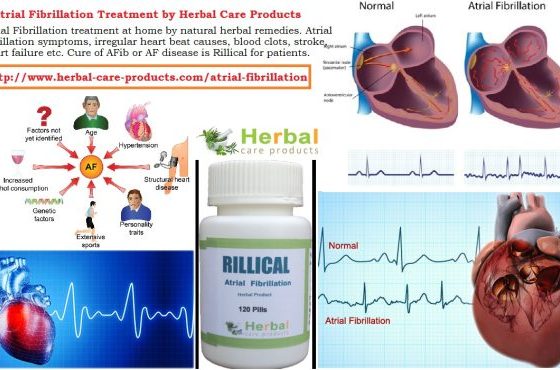 Treatment of Atrial Fibrillation Symptoms