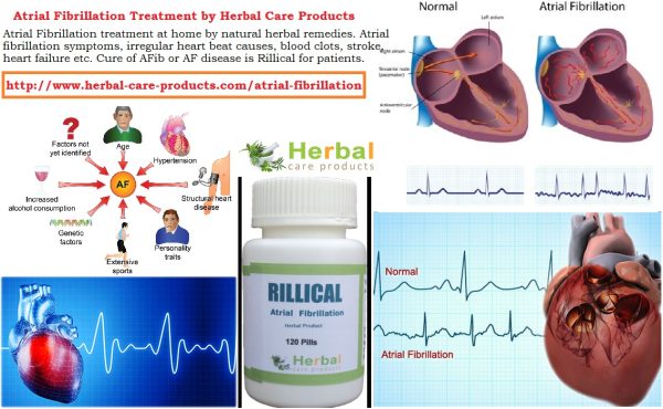 Treatment of Atrial Fibrillation Symptoms