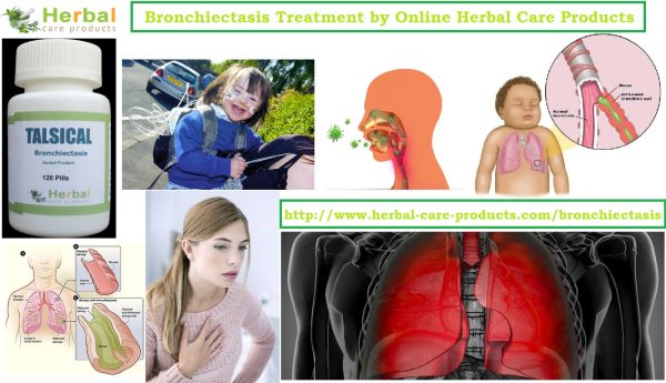 Treatment of Bronchiectasis by Natural Herbal Remedies