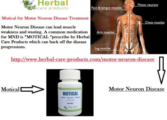 10 Natural Remedies for Motor Neuron Disease