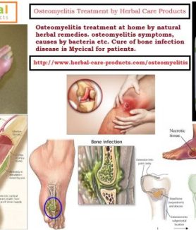 10 Natural Remedies for Osteomyelitis