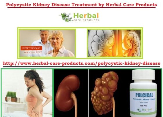 10 Natural Remedies for Polycystic Kidney Disease