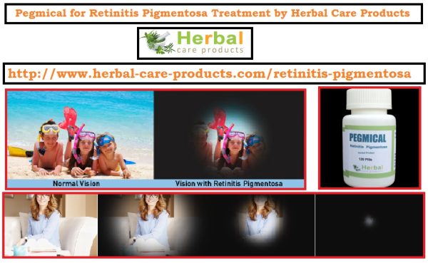 10 Natural Remedies for Retinitis Pigmentosa