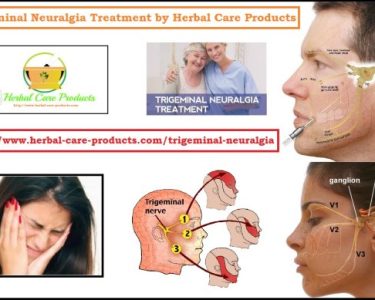 10 Natural Remedies for Trigeminal Neuralgia