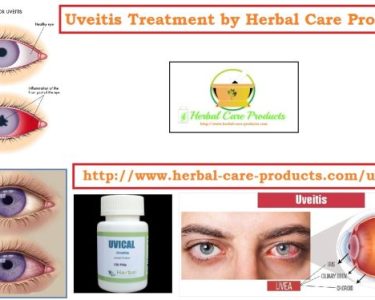 10 Natural Remedies for Uveitis