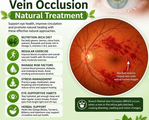 Branch Retinal Vein Occlusion Natural Treatment