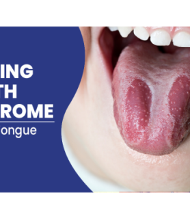 Burning Mouth Syndrome, after drinking alcohol mouth feels
