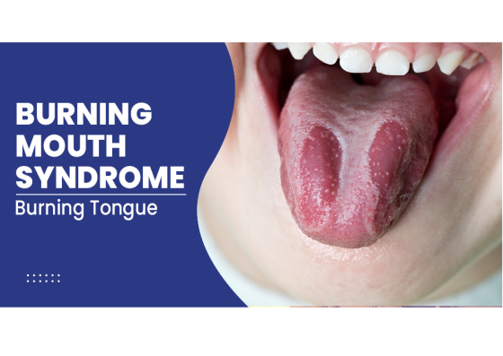 Burning Mouth Syndrome, after drinking alcohol mouth feels