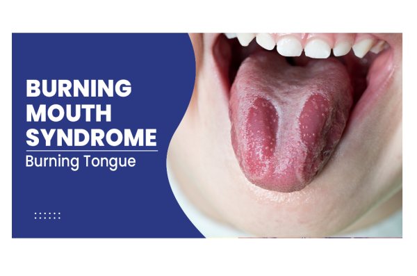 Burning Mouth Syndrome, after drinking alcohol mouth feels