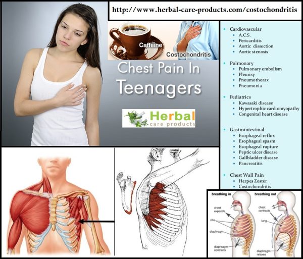11 Natural Remedies for Costochondritis