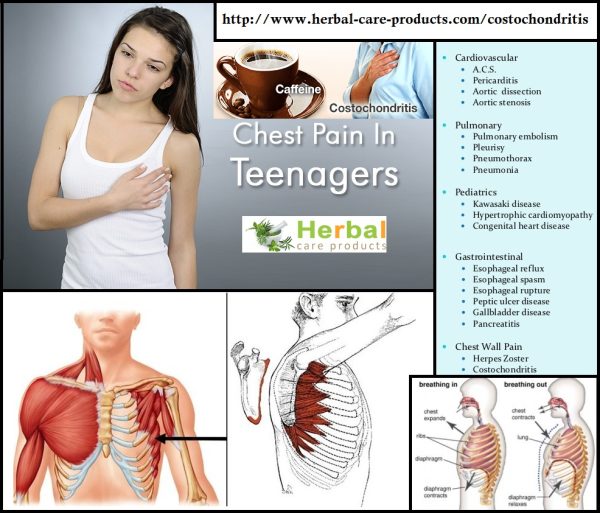 Costochondritis Natural Herbal Remedies for Pain