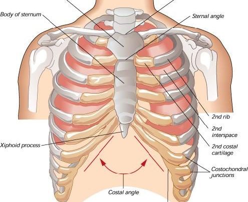 Costochondritis – Induced Chest Pain
