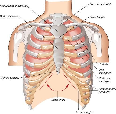 Costochondritis – Induced Chest Pain
