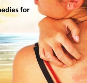 Effective Remedies for Prickly Heat That Work