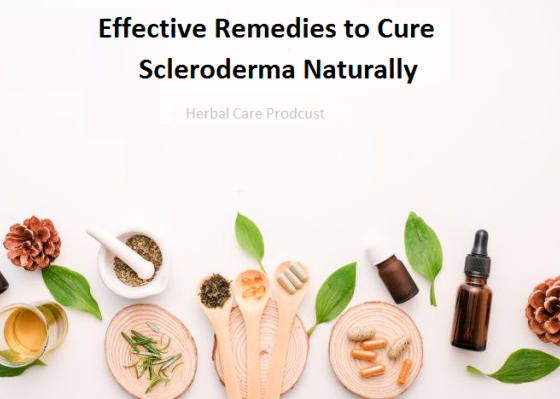 Effective Remedies to Cure Scleroderma Naturally