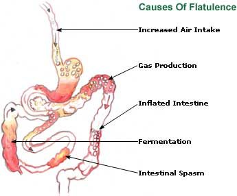 Flatulence – Digestive Flatus