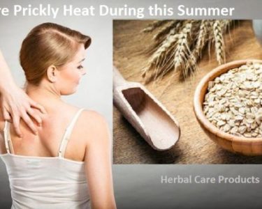 How to Cure Prickly Heat Rash During this Summer