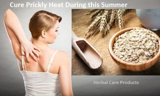 How to Cure Prickly Heat Rash During this Summer