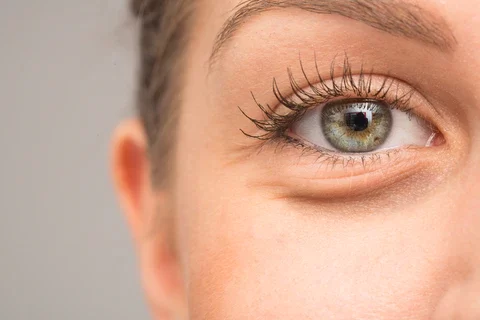 Loosening of Skin Under the Eyes: Natural Remedies to Tighten