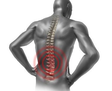 Myelitis – Infectious Spinal Cord
