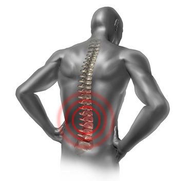 Myelitis – Infectious Spinal Cord