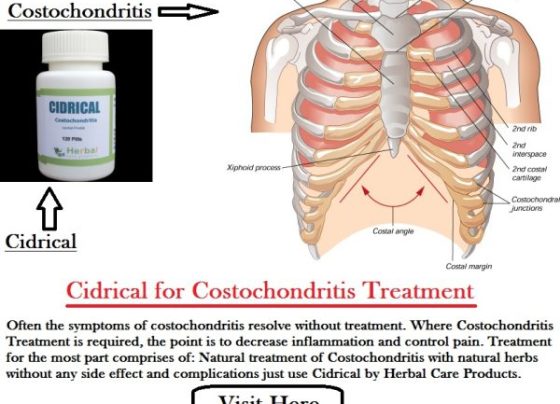 Natural Herbal Remedies for Costochondritis