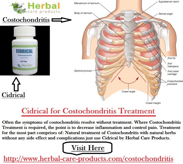 Natural Herbal Remedies for Costochondritis