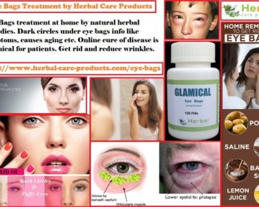 Natural Herbal Treatment for Eye Bags and Symptoms, Causes