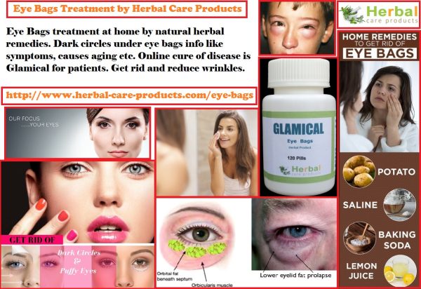 Natural Herbal Treatment for Eye Bags and Symptoms, Causes
