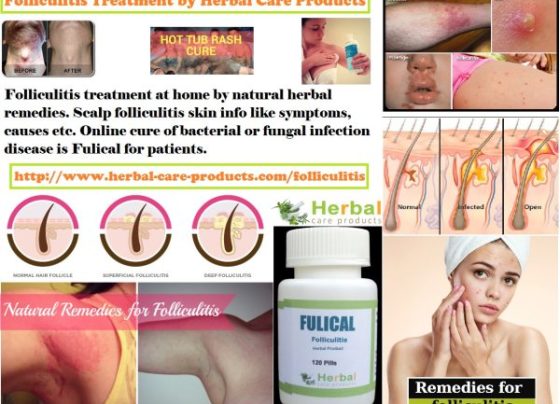 Natural Herbal Treatment for Folliculitis and Symptoms, Causes