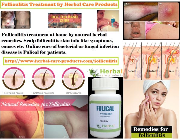 Natural Herbal Treatment for Folliculitis and Symptoms, Causes