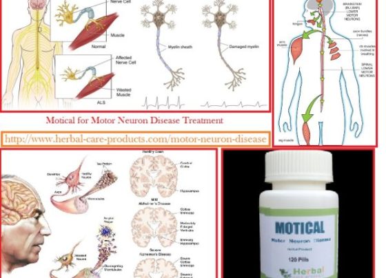 Natural Herbal Treatment for Motor Neuron Disease and Symptoms, Causes