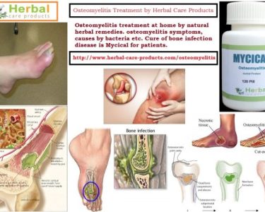 Natural Herbal Treatment for Osteomyelitis and Symptoms, Causes