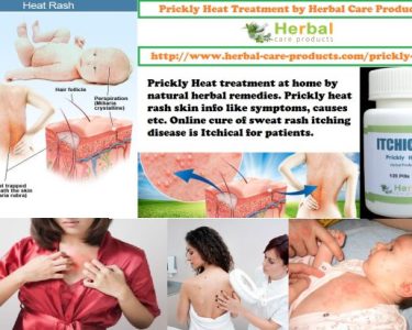 Natural Herbal Treatment for Prickly Heat and Symptoms, Causes