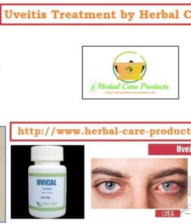 Natural Herbal Treatment for Uveitis Symptoms and Causes