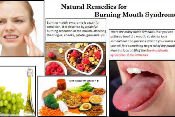 Burning Mouth Syndrome Home Remedies, Herbal Product for Burning Mouth Syndrome, Herbal Remedies for Burning Mouth Syndrome, Herbal Supplement for Burning Mouth Syndrome, herbal treatment for burning mouth syndrome, Home Remedies for Burning Mouth Syndrome, Natural Remedies for Burning Mouth Syndrome
