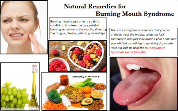 Soothing the Burn: Natural Home Remedies for Burning Mouth Syndrome
