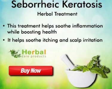 Natural Remedies for Seborrheic Keratosis at Home