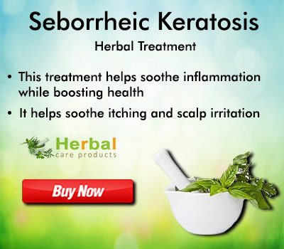 Natural Remedies for Seborrheic Keratosis at Home