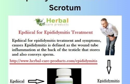 Natural Treatment for Epididymitis Pain in the Scrotum
