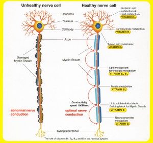 Peripheral Neuropathy - Traumatic Nervous Injury