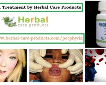 Porphyria Natural Herbal Treatment